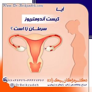 تشخیص اندومتر