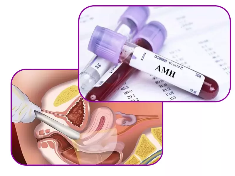 بررسی پیشرفت در IVF یا لقاح مصنوعی