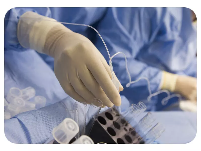 استخراج تخمک ها در IVF یا لقاح مصنوعی