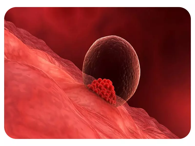 انتقال جنین در IVF یا لقاح مصنوعی
