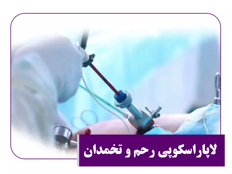 لاپاراسکوپی رحم و تخمدان