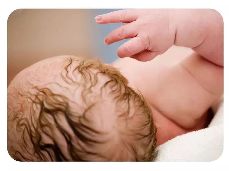 پیچش بند ناف دور گردن جنین