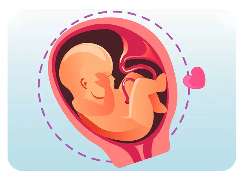 پیچش بند ناف دور گردن جنین در شکم مادر