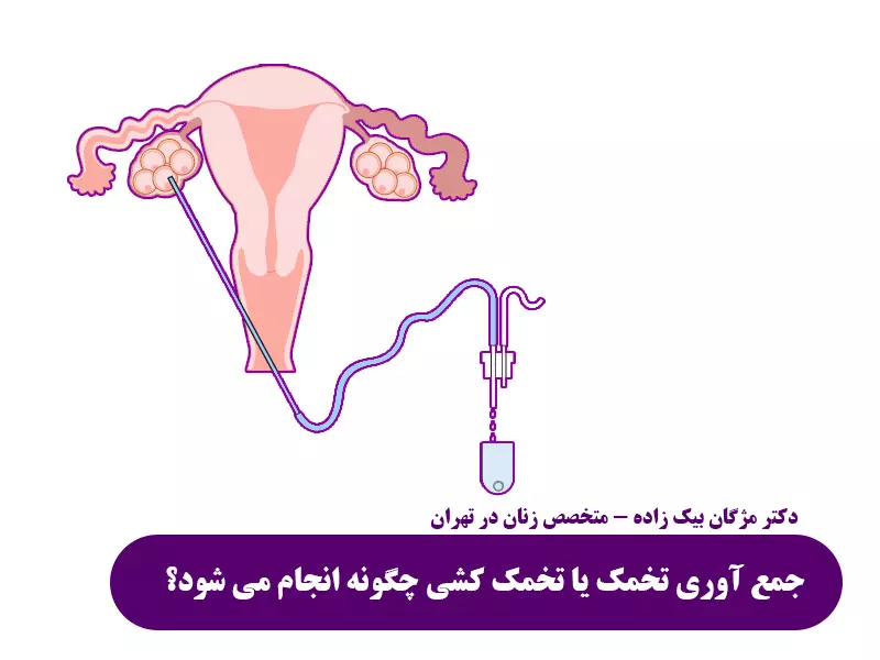 جمع آوری تخمک