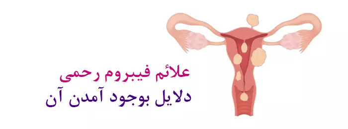 علائم فیبروم رحمی چیست