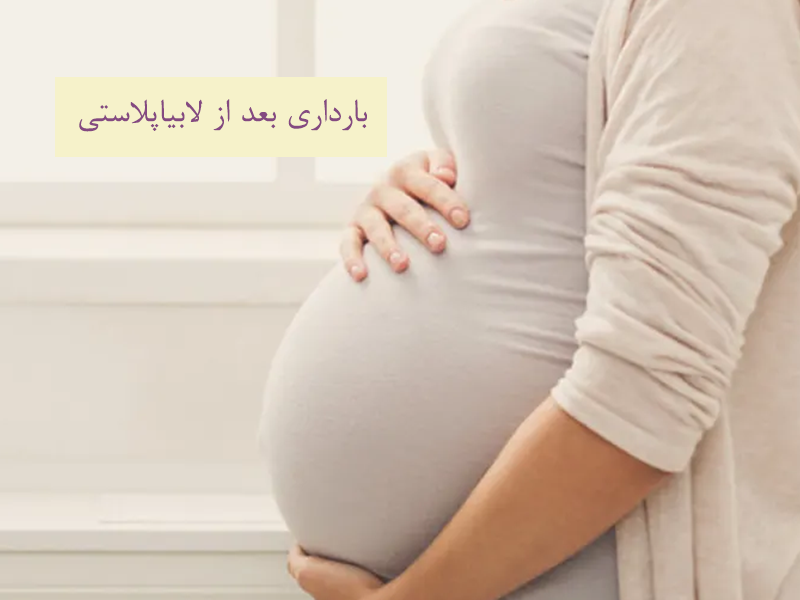 بارداری بعد از لابیاپلاستی