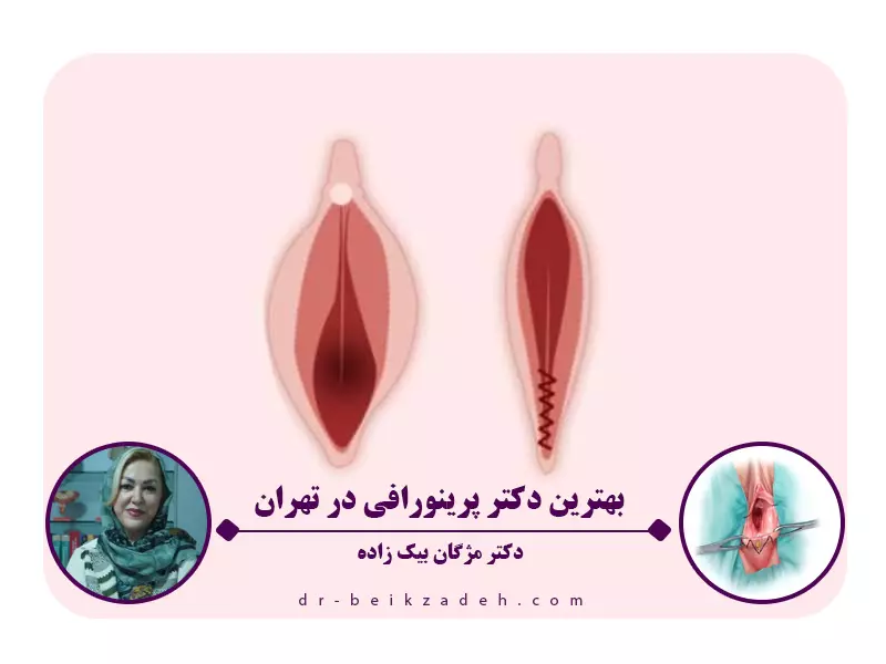 بهترین دکتر پرینورافی در تهران
