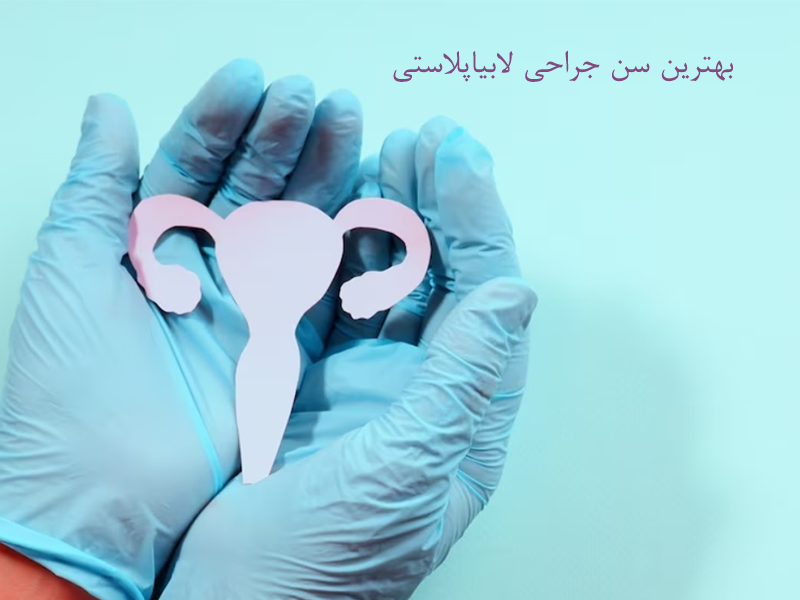 بهترین سن لابیاپلاستی چه سنی است؟