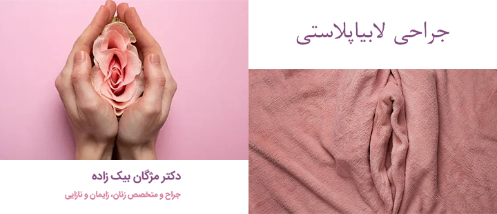 جراحی لابیاپلاستی