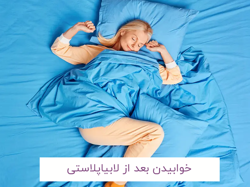 خوابیدن بعد از لابیاپلاستی