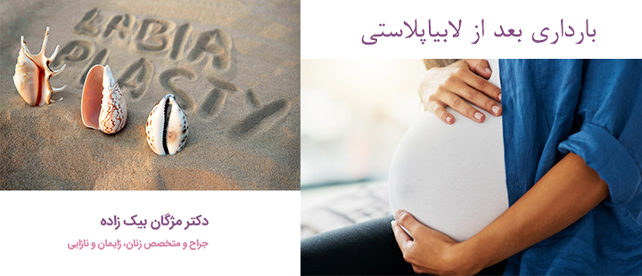 درباره بارداری بعد از لابیاپلاستی