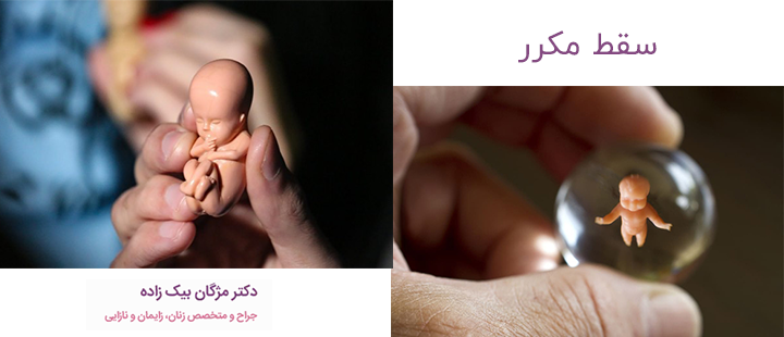 سقط مکرر