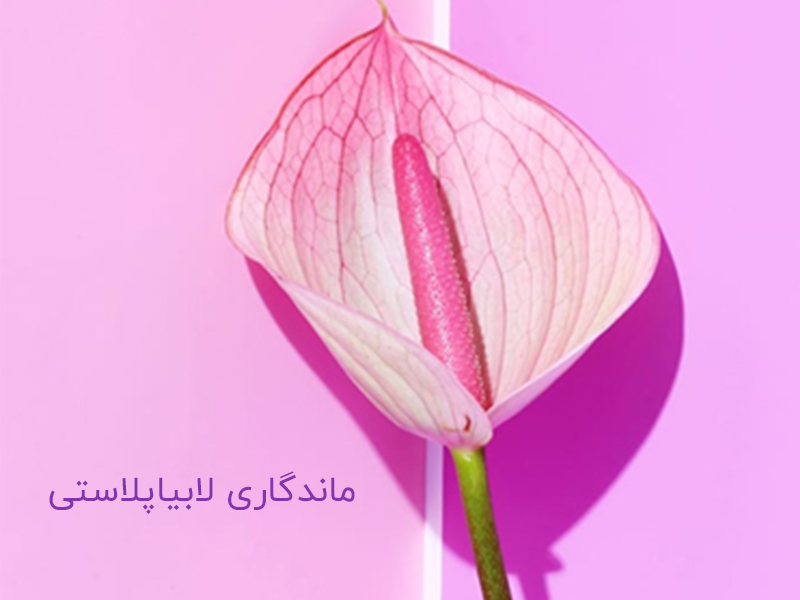 ماندگاری لابیاپلاستی