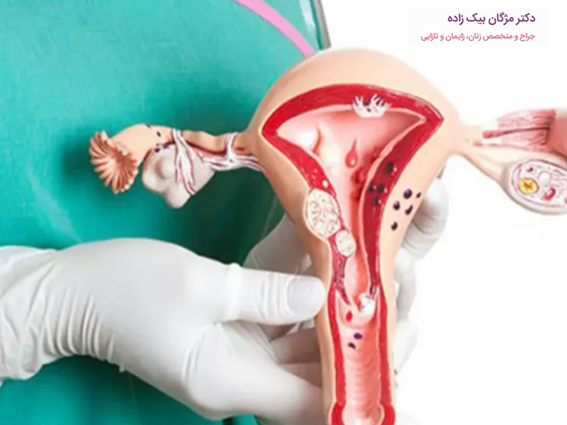 هیستروسکوپی رحم و کاربرد آن