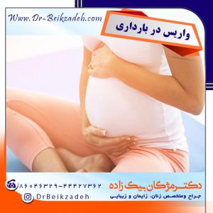 واریس در بارداری
