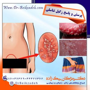 پرسش و پاسخ درباره زگیل تناسلی